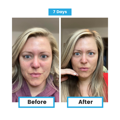 Antioxidant NEUMI skin REVOLÚCIA v KOZMETIKE nano-veľký glutatión pre výživu Vašej pokožky na najhlbších úrovniach