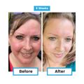 Antioxidant NEUMI skin REVOLÚCIA v KOZMETIKE nano-veľký glutatión pre výživu Vašej pokožky na najhlbších úrovniach