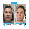 Antioxidant NEUMI skin REVOLÚCIA v KOZMETIKE nano-veľký glutatión pre výživu Vašej pokožky na najhlbších úrovniach