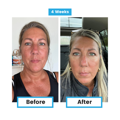 Antioxidant NEUMI skin REVOLÚCIA v KOZMETIKE nano-veľký glutatión pre výživu Vašej pokožky na najhlbších úrovniach