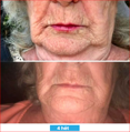 Antioxidant NEUMI skin REVOLÚCIA v KOZMETIKE nano-veľký glutatión pre výživu Vašej pokožky na najhlbších úrovniach