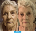 Antioxidant NEUMI skin REVOLÚCIA v KOZMETIKE nano-veľký glutatión pre výživu Vašej pokožky na najhlbších úrovniach