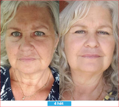 Antioxidant NEUMI skin REVOLÚCIA v KOZMETIKE nano-veľký glutatión pre výživu Vašej pokožky na najhlbších úrovniach