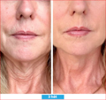 Antioxidant NEUMI skin REVOLÚCIA v KOZMETIKE nano-veľký glutatión pre výživu Vašej pokožky na najhlbších úrovniach