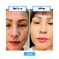 Antioxidant NEUMI skin REVOLÚCIA v KOZMETIKE nano-veľký glutatión pre výživu Vašej pokožky na najhlbších úrovniach