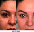 Antioxidant NEUMI skin REVOLÚCIA v KOZMETIKE nano-veľký glutatión pre výživu Vašej pokožky na najhlbších úrovniach