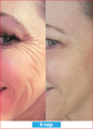 Antioxidant NEUMI skin REVOLÚCIA v KOZMETIKE nano-veľký glutatión pre výživu Vašej pokožky na najhlbších úrovniach