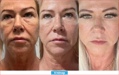Antioxidant NEUMI skin REVOLÚCIA v KOZMETIKE nano-veľký glutatión pre výživu Vašej pokožky na najhlbších úrovniach