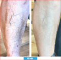 Antioxidant NEUMI skin REVOLÚCIA v KOZMETIKE nano-veľký glutatión pre výživu Vašej pokožky na najhlbších úrovniach