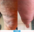 Antioxidant NEUMI skin REVOLÚCIA v KOZMETIKE nano-veľký glutatión pre výživu Vašej pokožky na najhlbších úrovniach