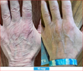 Antioxidant NEUMI skin REVOLÚCIA v KOZMETIKE nano-veľký glutatión pre výživu Vašej pokožky na najhlbších úrovniach