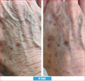 Antioxidant NEUMI skin REVOLÚCIA v KOZMETIKE nano-veľký glutatión pre výživu Vašej pokožky na najhlbších úrovniach