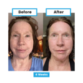 Antioxidant NEUMI skin REVOLÚCIA v KOZMETIKE nano-veľký glutatión pre výživu Vašej pokožky na najhlbších úrovniach