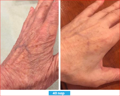 Antioxidant NEUMI skin REVOLÚCIA v KOZMETIKE nano-veľký glutatión pre výživu Vašej pokožky na najhlbších úrovniach