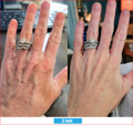 Antioxidant NEUMI skin REVOLÚCIA v KOZMETIKE nano-veľký glutatión pre výživu Vašej pokožky na najhlbších úrovniach