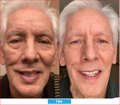 Antioxidant NEUMI skin REVOLÚCIA v KOZMETIKE nano-veľký glutatión pre výživu Vašej pokožky na najhlbších úrovniach
