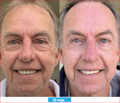 Antioxidant NEUMI skin REVOLÚCIA v KOZMETIKE nano-veľký glutatión pre výživu Vašej pokožky na najhlbších úrovniach