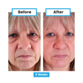 Antioxidant NEUMI skin REVOLÚCIA v KOZMETIKE nano-veľký glutatión pre výživu Vašej pokožky na najhlbších úrovniach