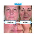 Antioxidant NEUMI skin REVOLÚCIA v KOZMETIKE nano-veľký glutatión pre výživu Vašej pokožky na najhlbších úrovniach