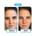 Antioxidant NEUMI skin REVOLÚCIA v KOZMETIKE nano-veľký glutatión pre výživu Vašej pokožky na najhlbších úrovniach