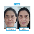 Antioxidant NEUMI skin REVOLÚCIA v KOZMETIKE nano-veľký glutatión pre výživu Vašej pokožky na najhlbších úrovniach