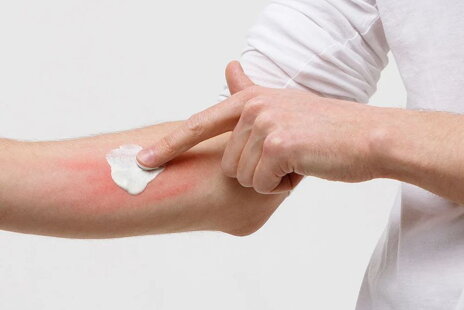  Revolutionizing skincare: how Healpsorin emollient balm soothes and fortifies skin with the power of nature